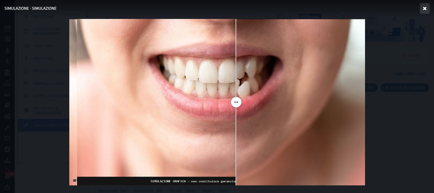 Il confronto prima/dopo a tutto schermo: trascinando la maniglia si passa dal sorriso di oggi a quello simulato, con l'avvertenza di simulazione grafica impressa sull'immagine